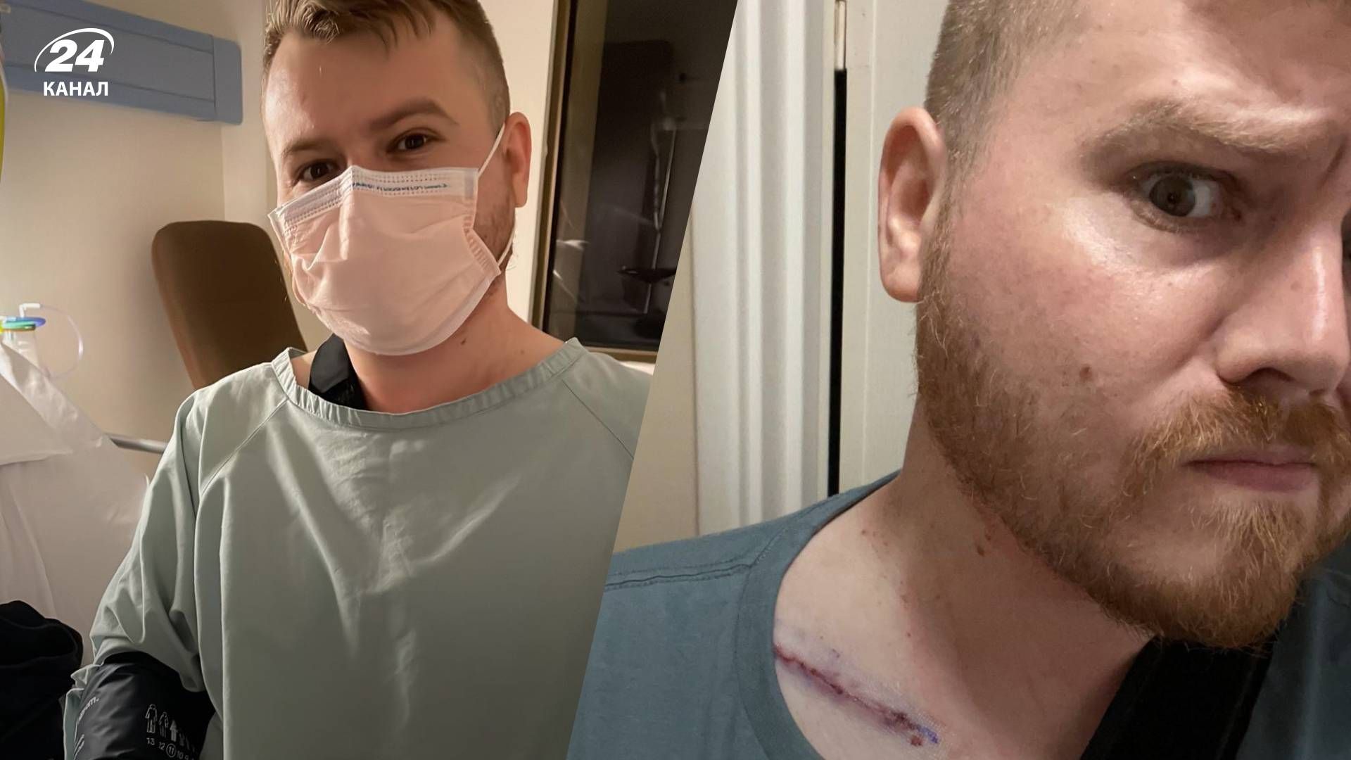 Стример розбив велосипед і зламав ключицю в прямому ефірі: відео Стример розбив велосипед і зламав ключицю в прямому ефірі: відео